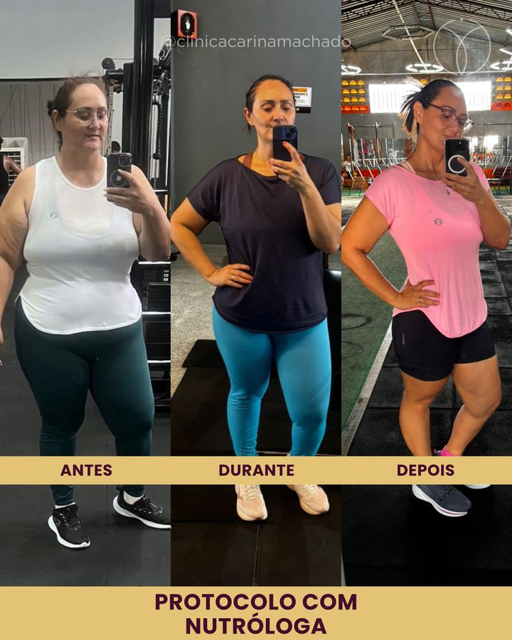 Antes e depois: Protocolo com nutróloga