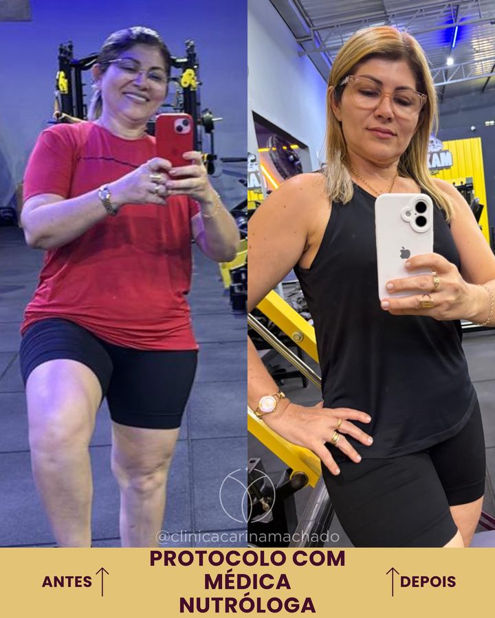 Antes e depois: Protocolo com nutróloga